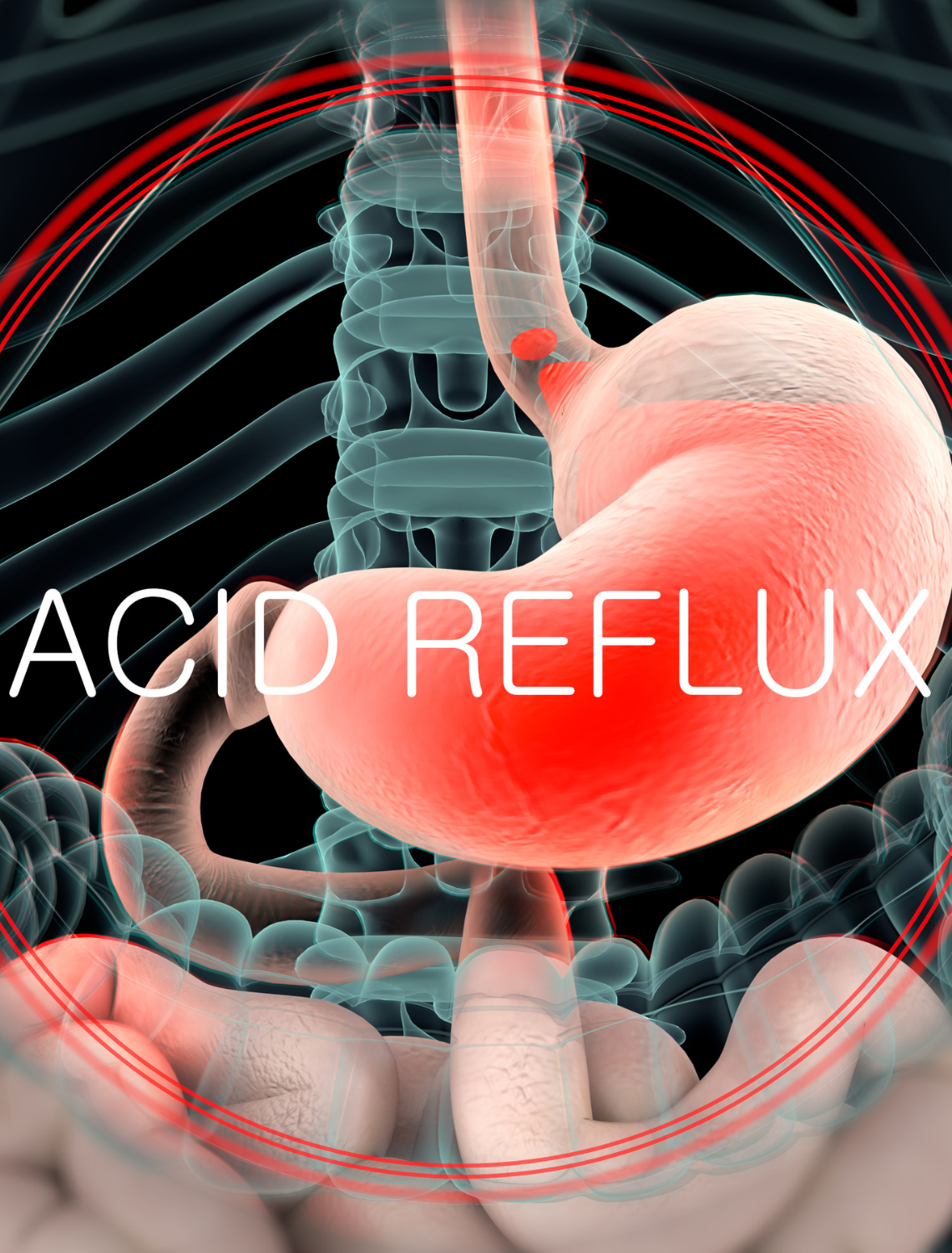 Does Drinking Hot Water or Cold Water Help Acid Reflux?